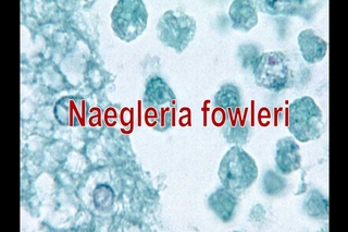 Naegleria fowleri