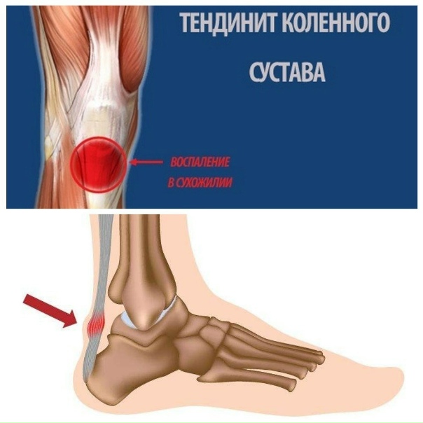 Pin on Sağlık Current, New community