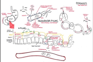 Microbiology - Helicobacter Pylori (Ulcer)